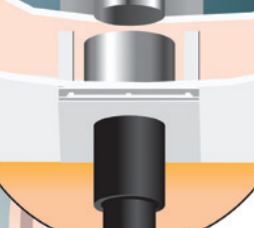 5 Inch (125mm) Twin Wall Flue Fire Stop Kit